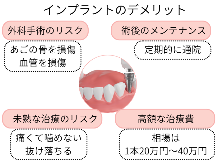 インプラントのデメリット