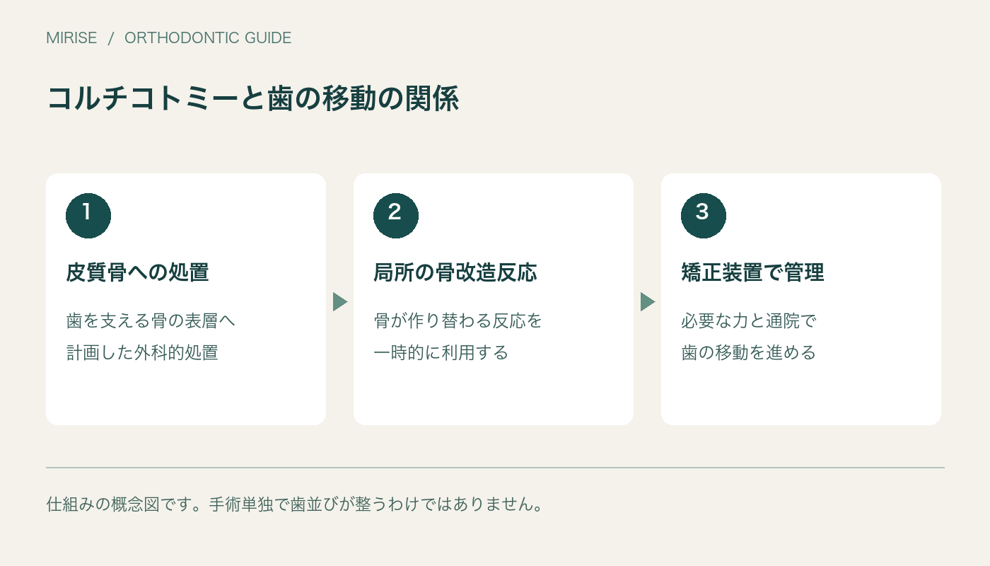 コルチコトミーと歯の移動の関係。皮質骨への処置、歯を支える骨の表層へ、計画した外科的処置。局所の骨改造反応、骨が作り替わる反応を、一時的に利用する。矯正装置で管理、必要な力と通院で、歯の移動を進める